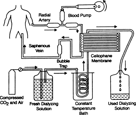 Write a note on artificial kidney.